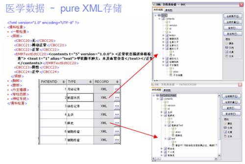 DB2 pureXML的技术应用及展望（图二）